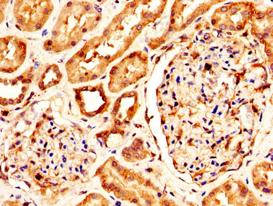 CSB-PA012446LA01HU
