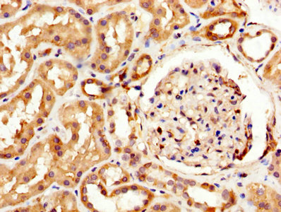 CSB-PA013322LA01HU