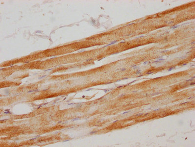 CSB-PA015299HA01HU