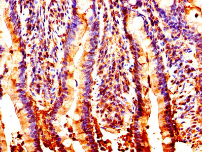 CSB-PA016146HA01HU