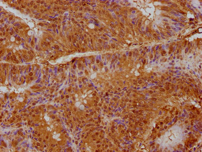 CSB-PA018424LA01HU