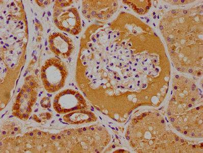 CSB-PA018996LA01HU