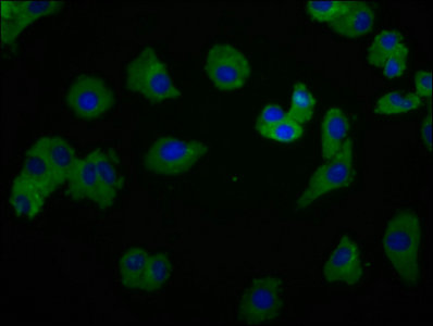 CSB-PA022998LA01HU
