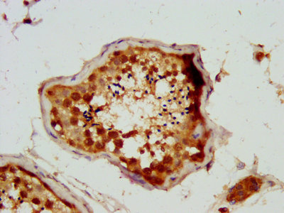 CSB-PA626626LA01HU