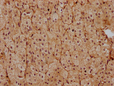 CSB-PA878932OA01HU