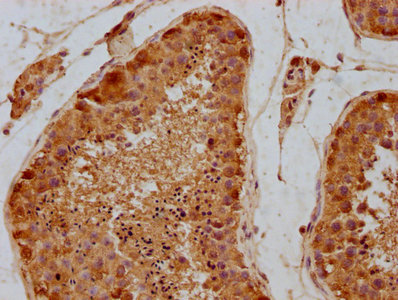 CSB-PA882173LA01HU