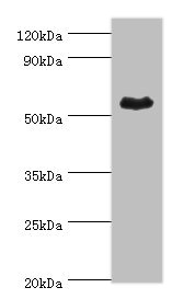 CSB-PA001565ESR1HU
