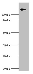 CSB-PA005739ESR2HU