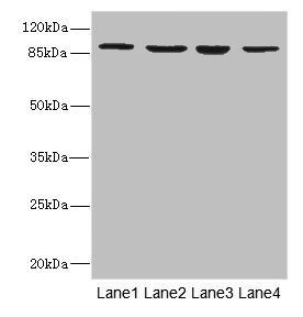 CSB-PA011891ESR1HU
