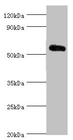 CSB-PA012394DSR2HU