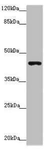 CSB-PA017321ESR1HU