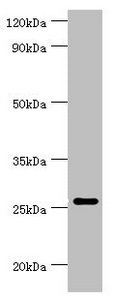 CSB-PA023989ESR1HU SDS