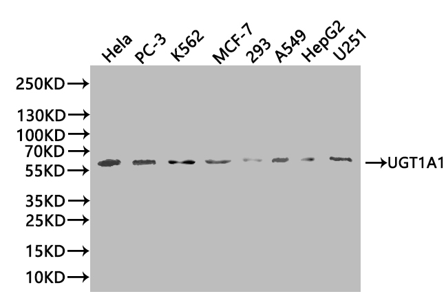 CSB-PA025570LA01HU