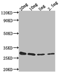 CSB-PA361030XA01MHK WB