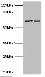 CSB-PA614418ESR1HU
