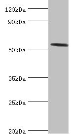 CSB-PA618635ESR2HU