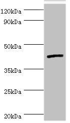 CSB-PA618901ESR1HU