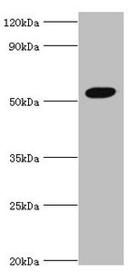 CSB-PA747778ESR1HU