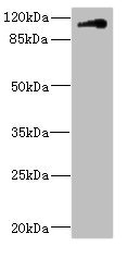 CSB-PA810284ESR2HU