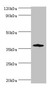 CSB-PA851547ESR1HU