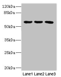 CSB-PA852884ESR2HU