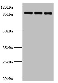 CSB-PA852885ESR1HU
