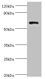 CSB-PA858702ESR1HU