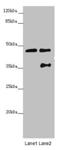 CSB-PA880157ESR1HU