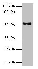 CSB-PA889106ESR1HU