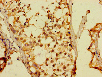 CSB-PA890667LA01HU