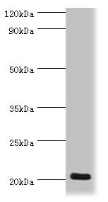 CSB-PA890741ESR1HU