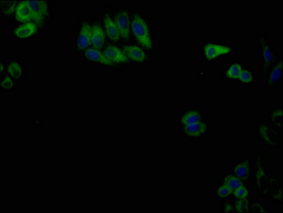 CSB-MA004485A1m