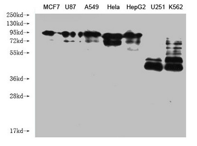 CSB-MA004485A1m