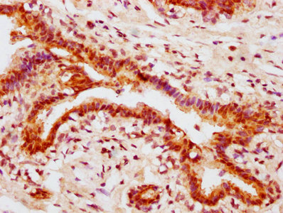 CSB-RA001553A473phHU IHC