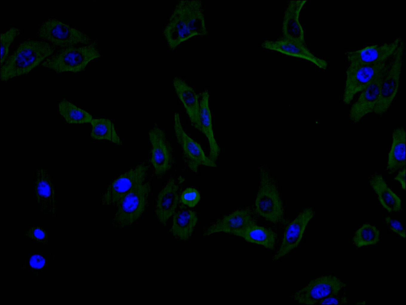 CSB-RA001827MA1HU