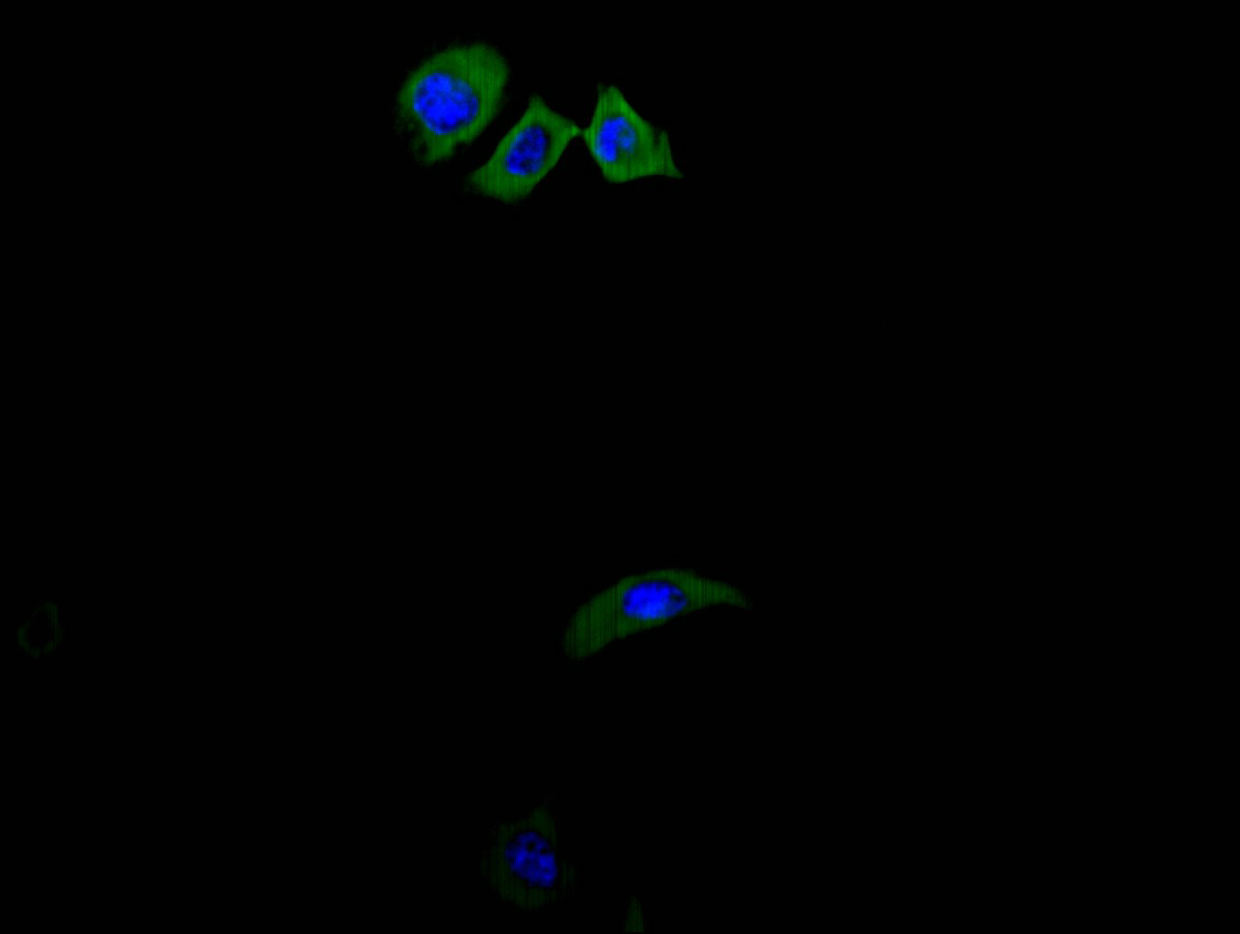 CSB-RA001827MA1HU