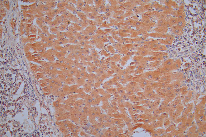 CSB-RA001836MA1HU