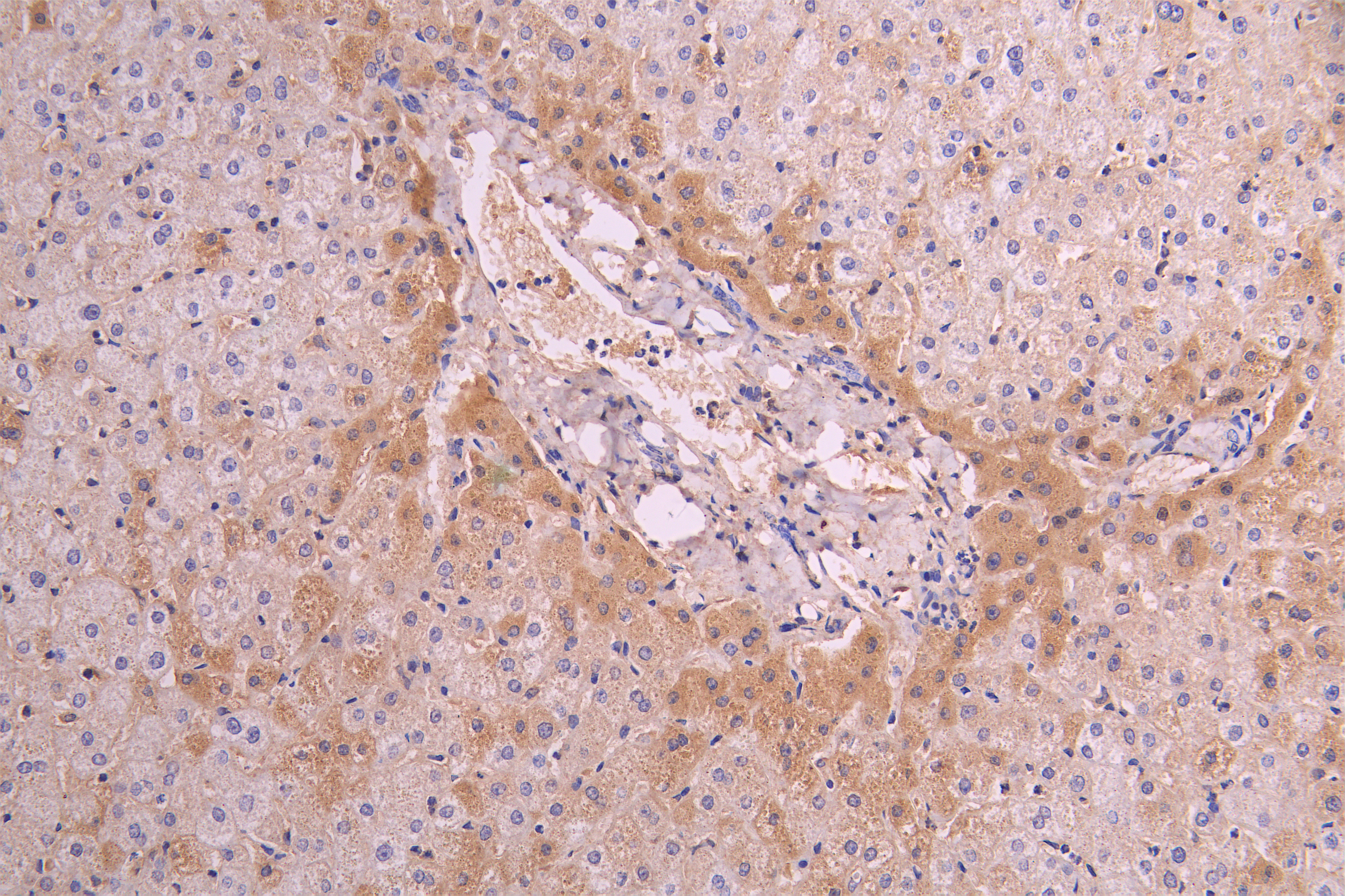 CSB-RA004879MA1HU