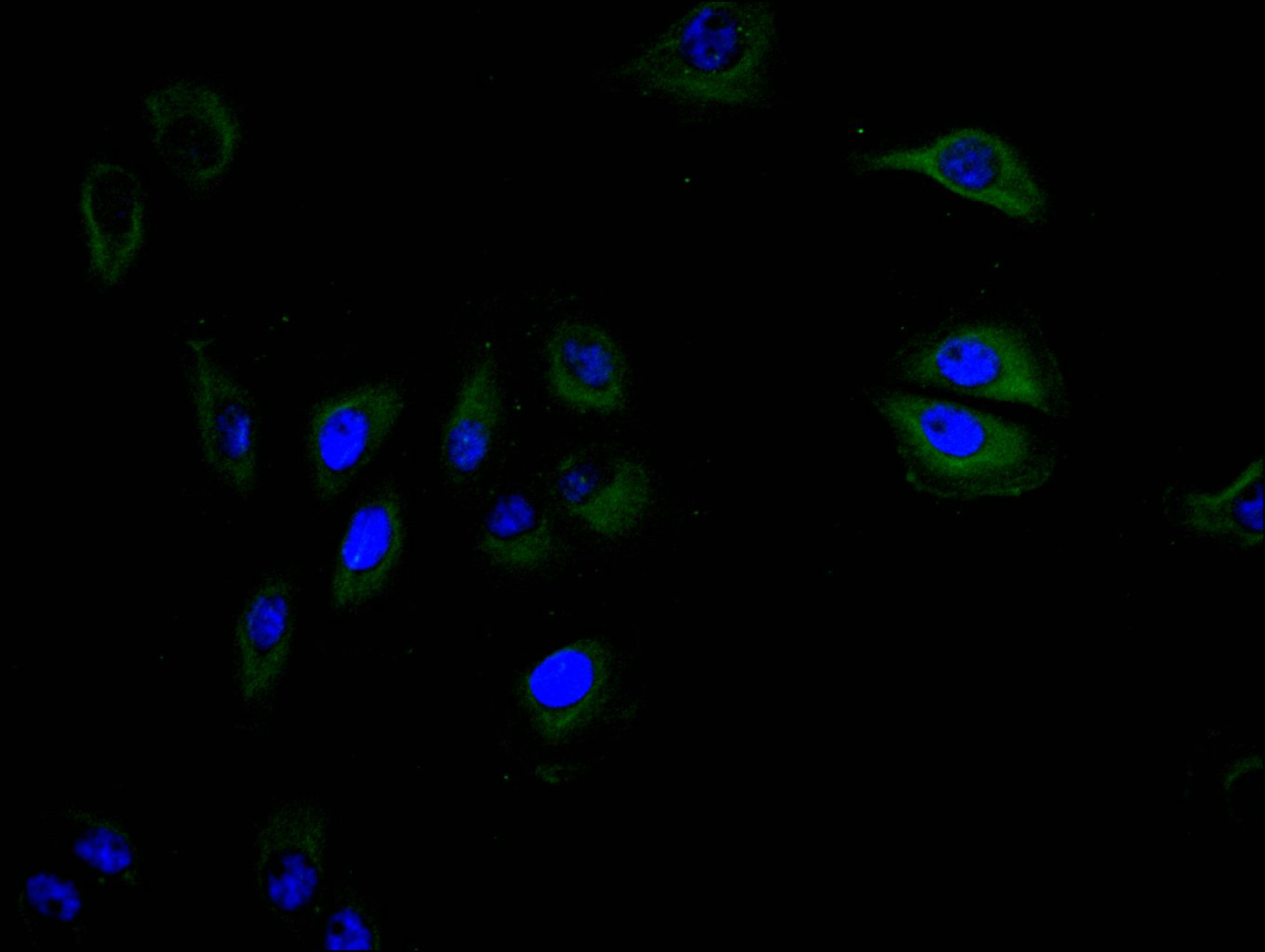 CSB-RA004936MA1HU