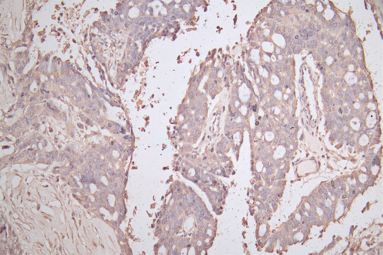 CSB-RA005034MA1HU