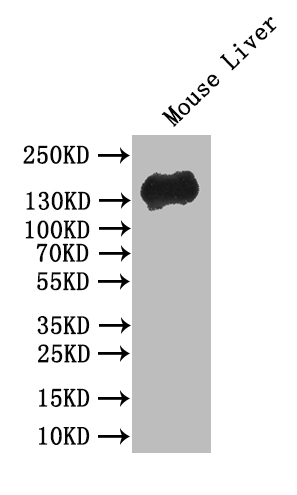 CSB-RA005034MA1HU
