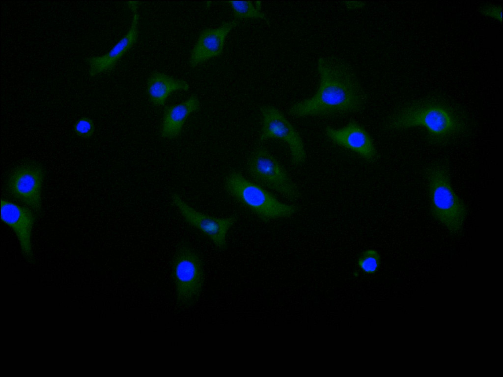 CSB-RA005036MA1HU