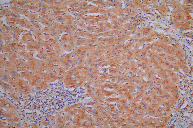 CSB-RA006193MA1HU