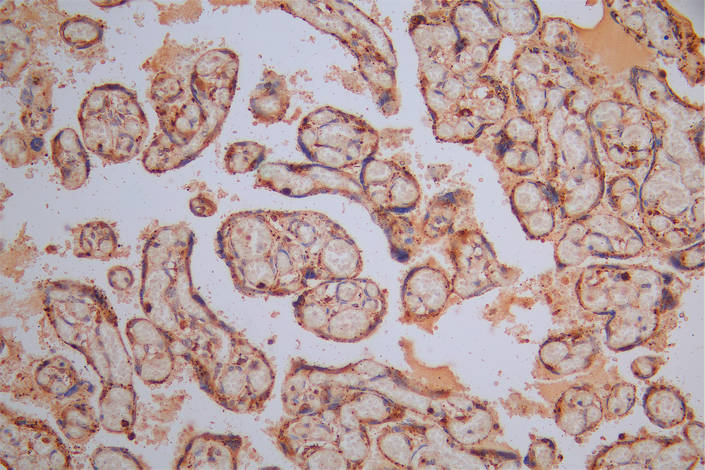 CSB-RA006193MA1HU