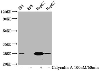 CSB-RA007556A209phHU