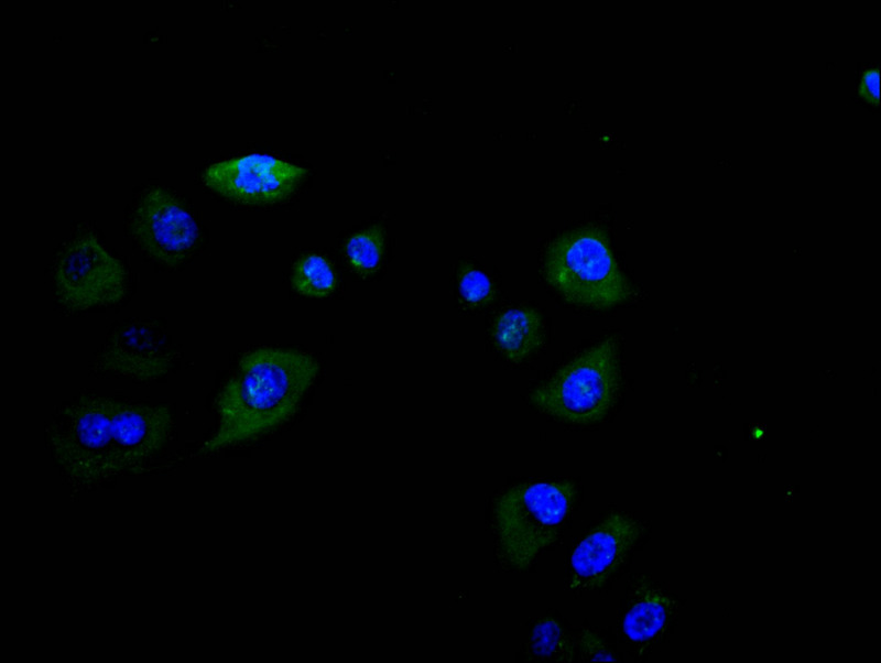 CSB-RA008543MA1HU