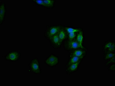 CSB-RA010078A641phHU