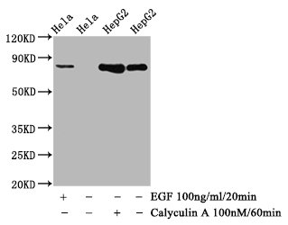 CSB-RA010078A641phHU