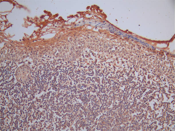 CSB-RA010082MA1HU