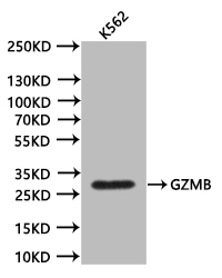 CSB-RA010082MA1HU